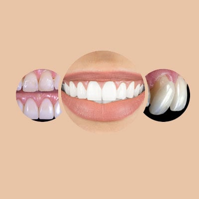 Smile Makeover: Principles and Techniques in Aesthetic Dentistry (1 Credit Hour)